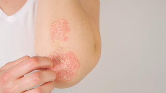 The pH of skin