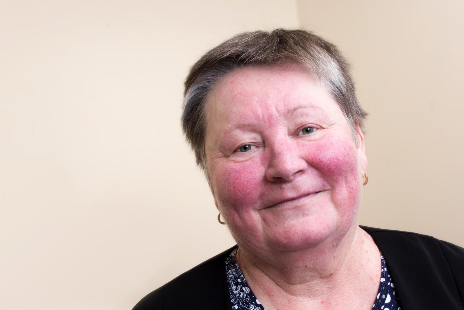 Topical Oxymetazoline: A Novel Approach to Treat Rosacea