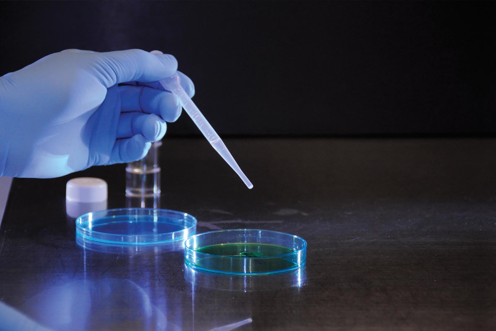 Folate deficiency and why folic acid supplements may NOT work